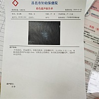 能看出男孩女孩吗？