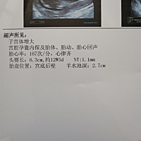 大家帮我看下，没啥大事吧，12周加5天，第一次做产检，只做了一个NT就回来了，医生没让做其它的检查
