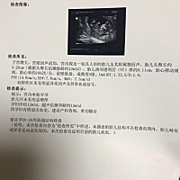 昨天去做的NT.医生说宝宝没完没了的动好不配合，做了五次才可以，又是爬楼梯，又是喝水，又是吃东西的，...
