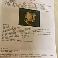 昨天照四维b超了，宝宝很健康！大神们帮我看下男女哦，谢谢🙏