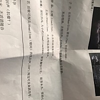 这有希望吗，有没有类似经历的，我那时候七周查的没有胎心胎芽，现在八周了好害怕不敢去医院，又想去医...