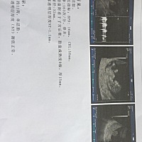 各位帮我看看是儿子还是女儿