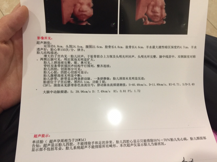 今天去做的四维，有会看男女的吗呵呵😄我很好奇是男是女！