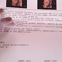 四维检查做了几次，宝宝不配合，爬楼几次。终于顺利通过。不知道看男女，希望可以如愿，大家也可以发表...
