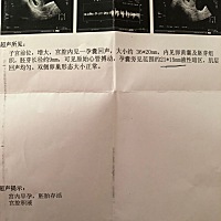 第一张是一周前测得，第二张是今天测得，今天早上突然出血了，血色不是鲜红色是暗红，现在是褐色，而且...