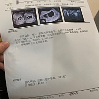 实属好奇，谁会看男宝还是女宝，谢谢啰。