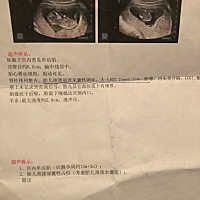 有没有这种情况的孕妈，该怎么办？昨天去做了无创DNA，要半个月才知道结果，怎么会形成这样的呢？是跟父...