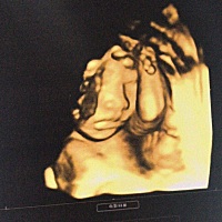 四维十来分钟一次性通过 在肚子里还跟着医生的仪器互动 是个胆大爱闹的娃🙄️