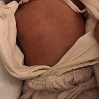 有没有知道宝宝屁股，身上都是什么啊