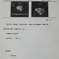 有没有人会看b超单，八周+2天，男孩女孩呢？？？