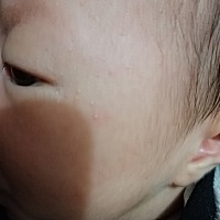 哪位宝妈能告诉我宝宝脸上的这是什么？该怎么护理？