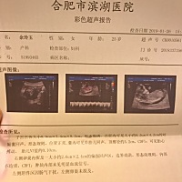 刚做完第一次产检。求懂的大神告知一下是佩琪还是乔治～ 都说宫体圆的是女儿😄ཽ我做梦梦见两次道士，...