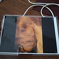 今天把她的四维照片拿去过塑了 以后等她长大了给她看看😄