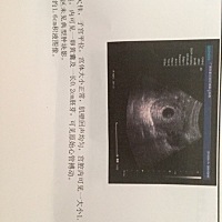 孕51天在医院做了阴超回来有褐色分泌物，医生建议保胎，打了两天保胎针，回家吃保胎胶囊➕孕酮片，这个b...