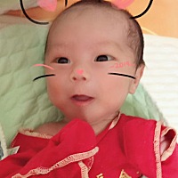 宝宝脸上起了湿疹，而且眉毛上一片黄色的痂，怎么才能好 满月时的小帅哥 马上两个月，怎么越来越丑了，...