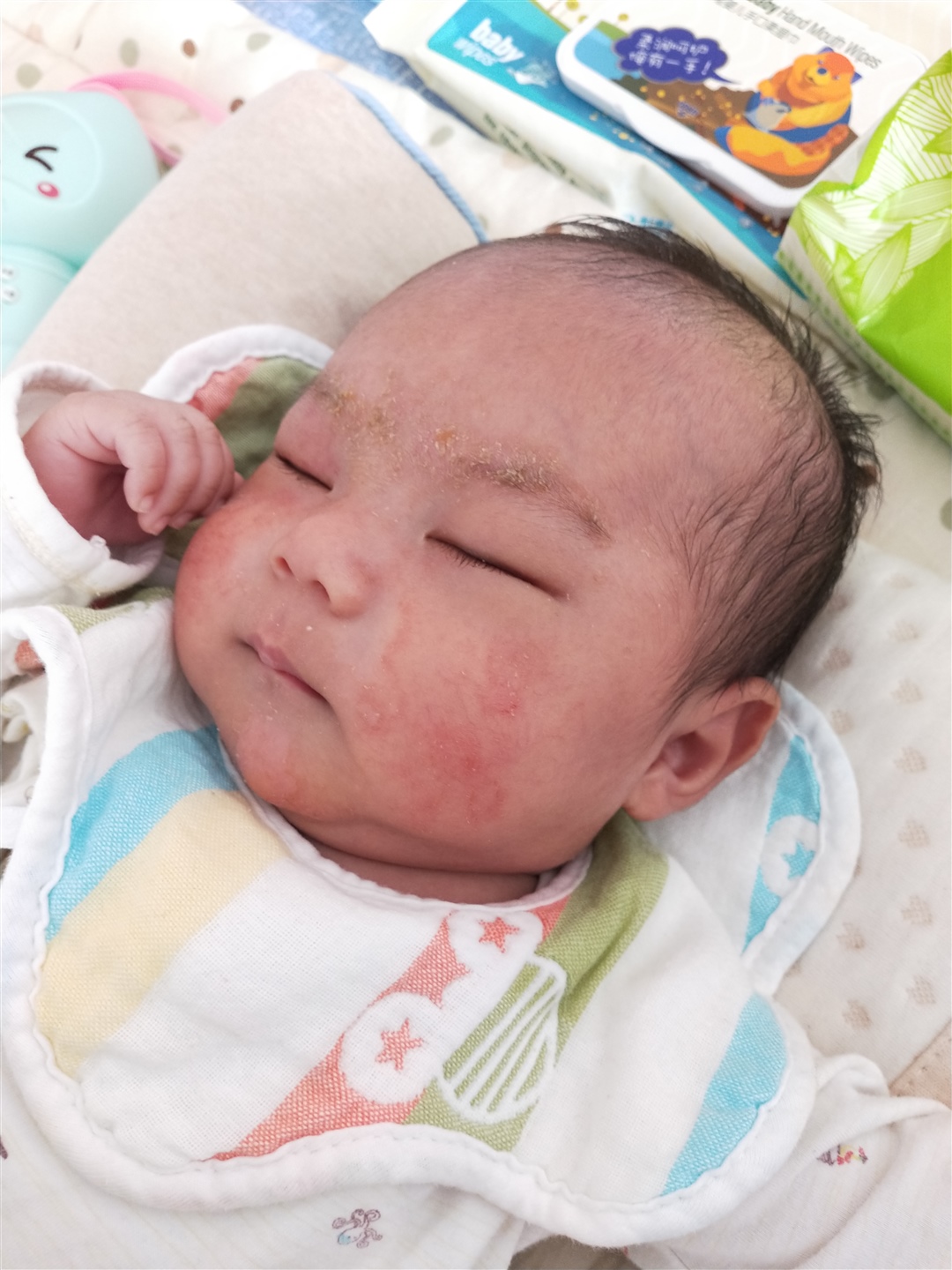 马上两个月，怎么越来越丑了，脸上还起了湿疹