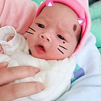 宝宝额头长了个胎记，不知道能不能去医院用激光治疗啊、费用贵不贵