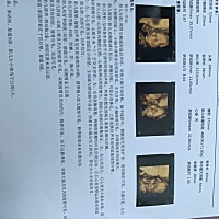 今天下上午刚检查完的，很好奇是男孩女孩🥰