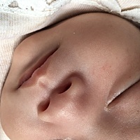 我儿子37天了，出生后脸上长了好多个小红点点怎么回事，有没有一样的