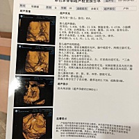 新鲜出炉四维图，大神们看看猜男女，实在是小家伙把自己抱得牢，好奇的紧