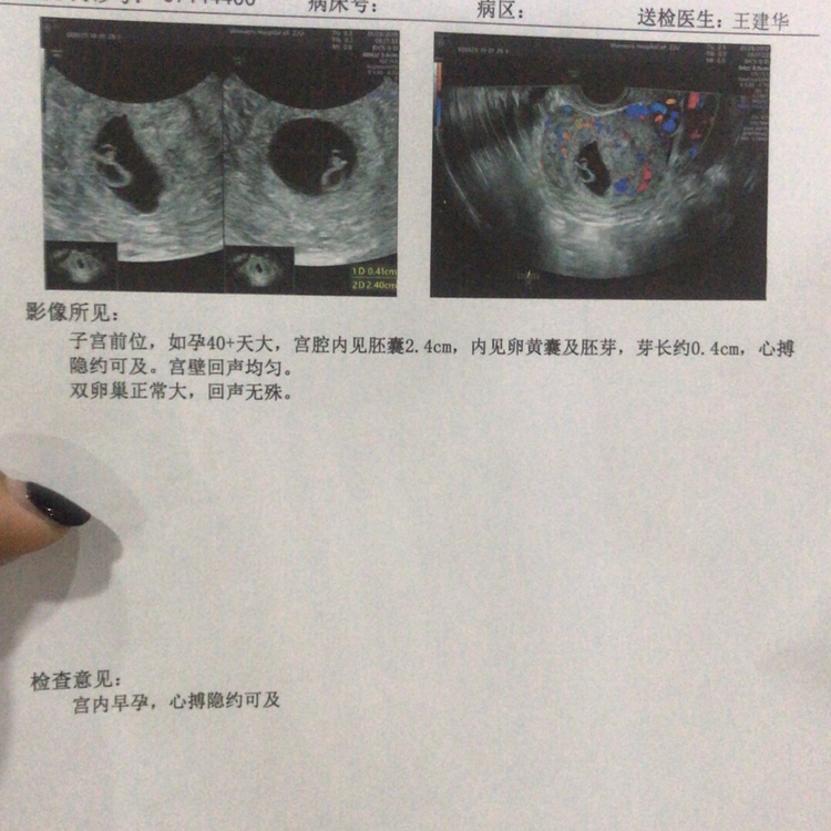 今天是第10周，B超上显示40来天、翻倍值、跌了这么多、还有没有希望？