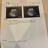 好奇一下 麻烦孕妈们看看，是男宝还是女宝呢……