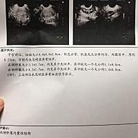 月经第十天，请问这有没有可能排两个卵子？