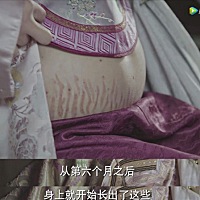 古代皇帝的太医院都治不了？孕妇妊娠纹到底有多可怕？ 妊娠纹对女人的伤害有多大，看《如懿传》里面海兰...