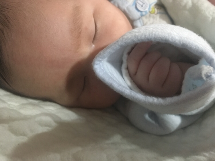 这脑壳中间是胎记吗？我个天那啊！