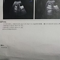 二胎，意外的有了，几个月能看出男女，已经有个5岁的儿子了，这胎好想要个女儿，有懂得吗？能通过数据看...