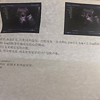 怀孕46天，少量出血一周了，今天做b超就是胎心落，帮我看看报告单有哪里不正常的吗