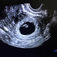 快两个月了，反应好大，哎，喝白开水也喝不下了，嘴巴总是没味道，吃也吃不的，希望宝宝健健康康