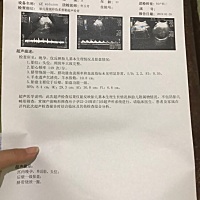 今天胎心监测，B超，脐带绕颈一圈，有宝妈知道如何绕过来吗？