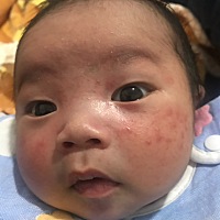 请教一下各位宝妈，这是热痱子吗？我感觉是我开始喂奶就开始长的，刚开始喂奶，胸摩擦到小脸都红了，就...