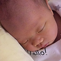 医生说的很严重，怕影响宝宝就照了黄疸，照了八个小时，回来头发少了点，头 身上也都脱皮了，还时不时的...