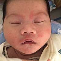 各位宝妈知道宝宝脸上长的什么吗一天比一天多