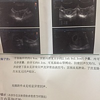 有会看的吗，请帮忙看一下昨天的单子，谢谢🙏