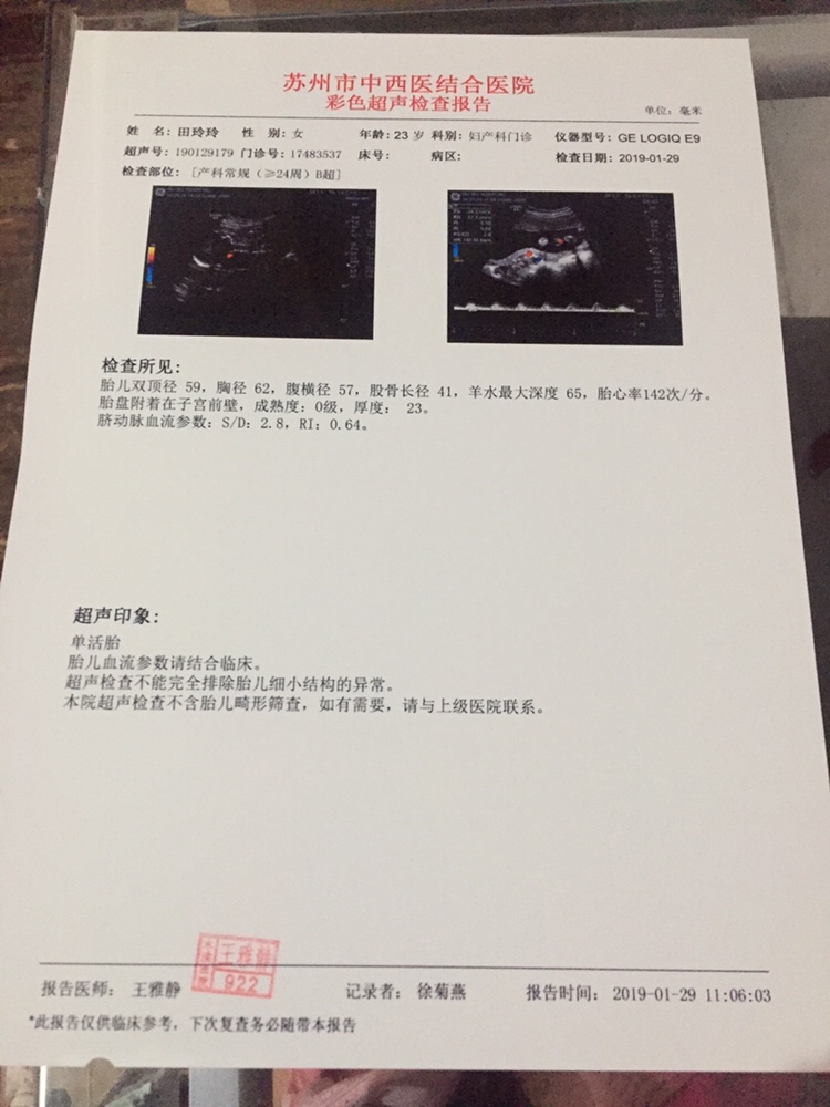 100天的时间检查是男孩，三个月就有轻微胎动，现在五个月胎动挺厉害，胎动也挺有规律的只要晚上躺到床上就会动，一放胎教音乐也会动，😄男宝女宝健康就好，就是比较想知道比较好奇😂