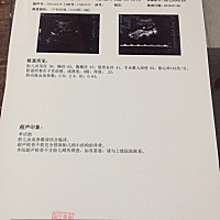 哪位亲会看男女？ 100天的时间检查是男孩，三个月就有轻微胎动，现在五个月胎动挺厉害，胎动也挺有规律...