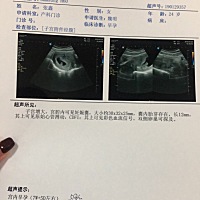 医生说发育挺好的，好奇男女，哈哈😄