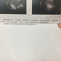 前一星期有褐色分泌物打了一星期黄体酮吃的保胎药终于能看到心跳了 激动的不行 目前是第七周  但是黄体...