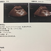 12.8日来的末次月经，30号，1号熬了两天夜，2号直接滴了五六滴血，我以为月经来了，等了几天没来就感觉...