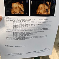 麻烦哪位懂看四维的，请帮忙看看，好奇啊，是男宝还是女宝，谢谢🙏