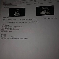 大家觉得像男宝还是女宝