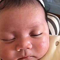 之前那么好的皮肤，现在成花脸猫了