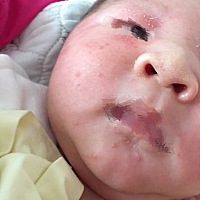 有没有人知道宝宝这脸上长的东西 怎么回事 越来越多。感觉很痒 他自己来抓！