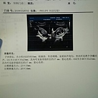 我的天，二胎B超归来，竟然是双胞胎  我和老公都是事业单位，大女儿已经2岁，婆婆想凑一个好字，这次二...