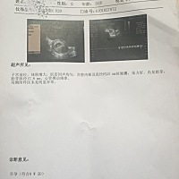 宫腔积液的宝妈别紧张，妈妈的好心情是宝宝最大的安全感  给大家分享一下个人经历，有再遇到宫腔积...