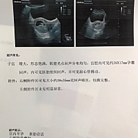 不知道这个右侧附件囊肿对胎儿又没有影响，很害怕