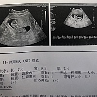 nt一次顺利通过，开心